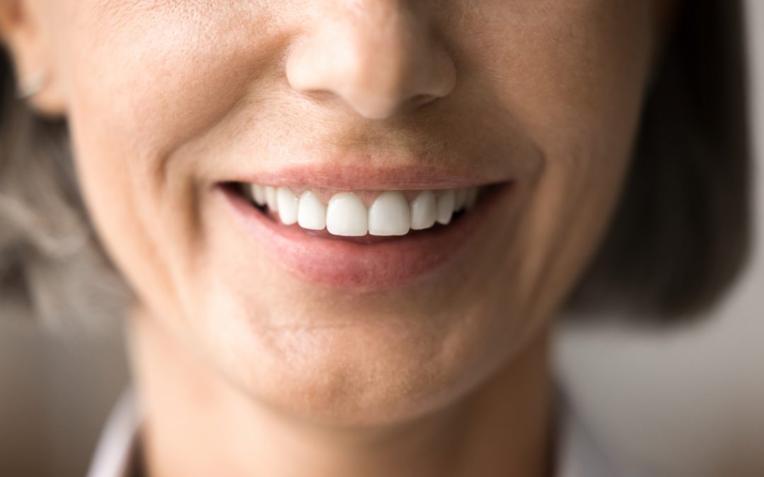 Factores clave en la osteointegración de un implante dental